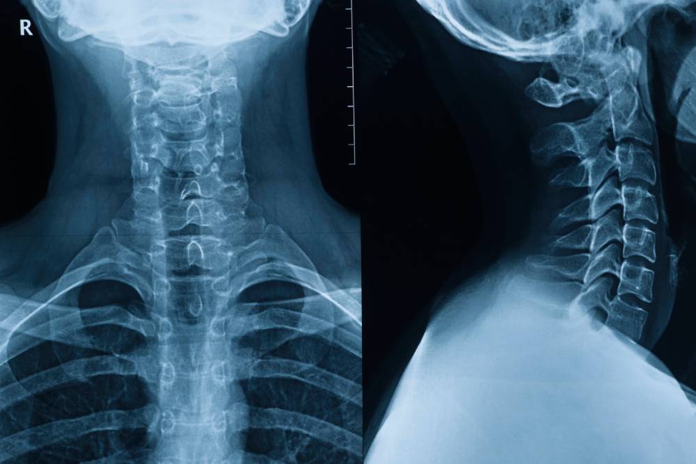 why on site x-ray matters in a chiropractic college clinic